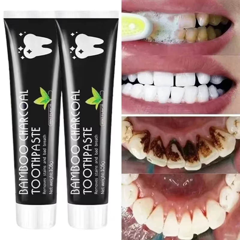 Teeth Whitening Charcoal - Отбеливающая зубная паста Зубная паста с