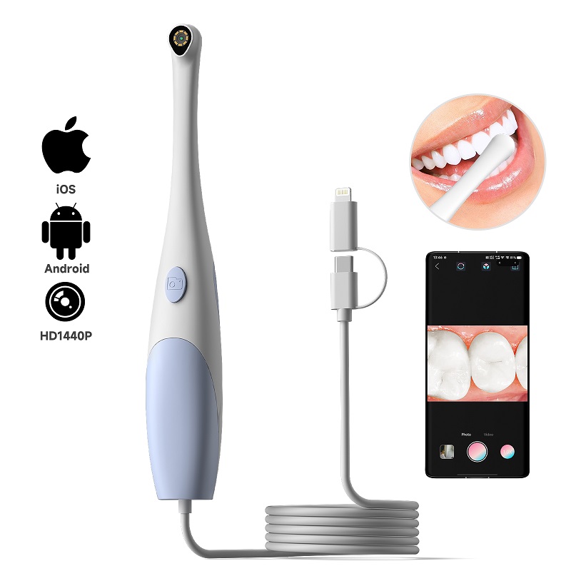 Teeth Whitening Video - Эндоскопическая камера для осмотра полости рта