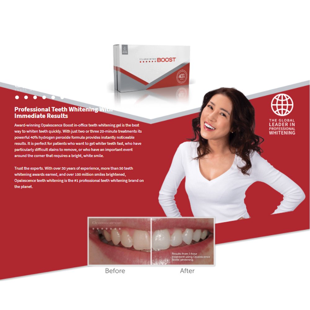 Opalescence Boost 40% PF Ameri – обзор и цена Teeth Whitening Opalescence
