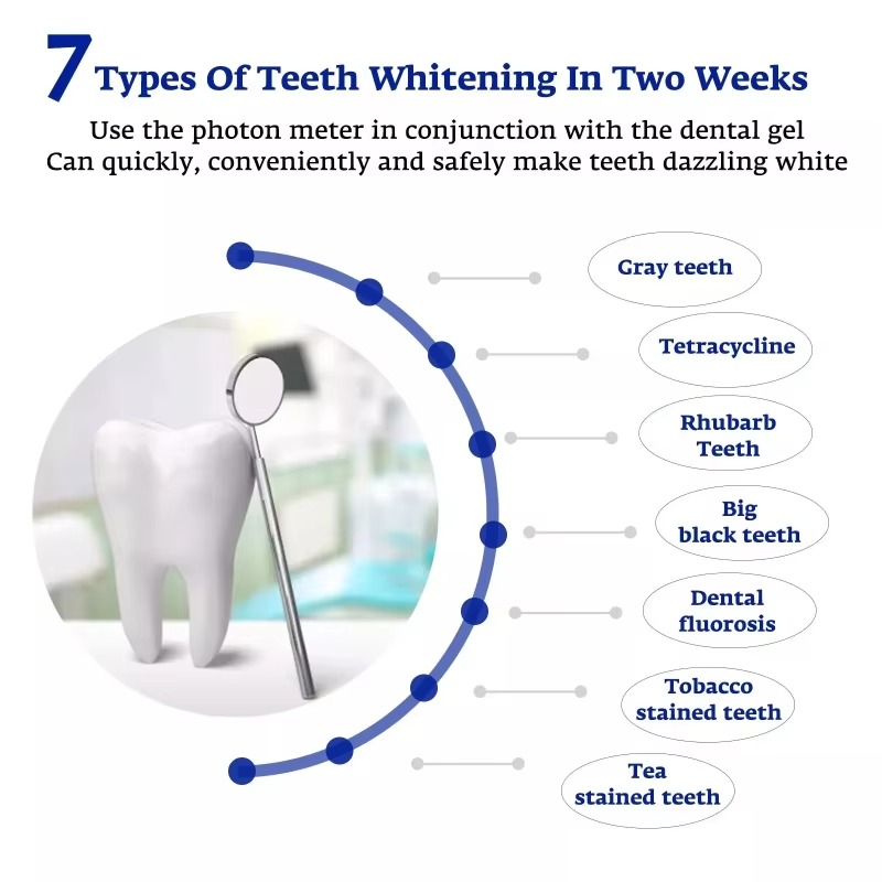 Интеллектуальная светодиодная  – обзор и цена Teeth Whitening With Trays