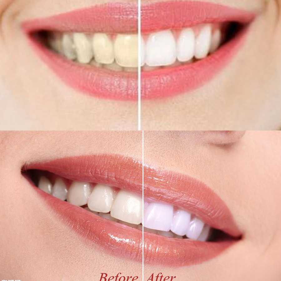 Бамбуковый уголь для зубов, ст – обзор и цена Teeth Whitening Charcoal