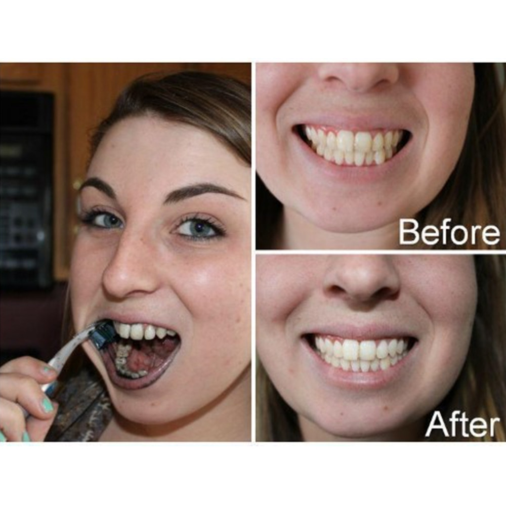 Бамбуковый уголь для зубов, ст – обзор и цена Teeth Whitening Charcoal