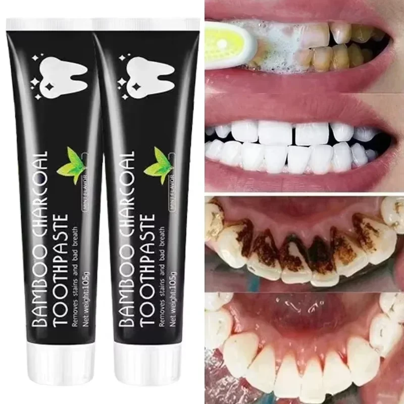 Отбеливающая зубная паста с ба – обзор и цена Teeth Whitening Charcoal