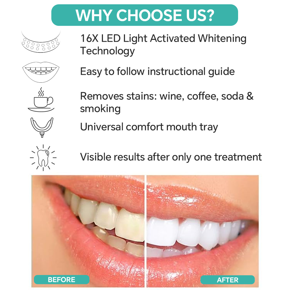 Устройство для отбеливания зуб – обзор и цена Led Mouth Tray