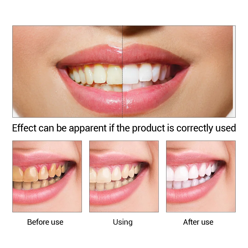 FTEENPLY отбеливание зубов быс – обзор и цена Teeth Whitening Cream