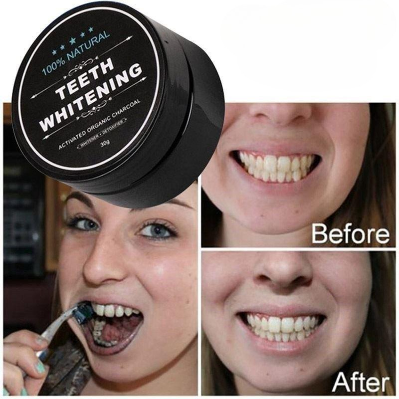 1 коробка порошка для отбелива – обзор и цена Teeth Whitening Charcoal