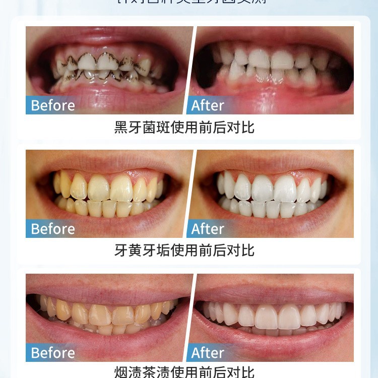 Японская ручная щетка для удал – обзор и цена Teeth Whitening In Japan