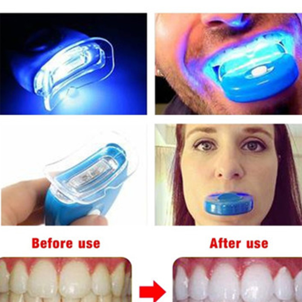 Новый синий светодиод отбелива – обзор и цена Teeth Whitening Video