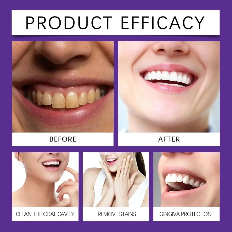 Минеральный порошок для восста – обзор и цена Teeth Whitening Zimba