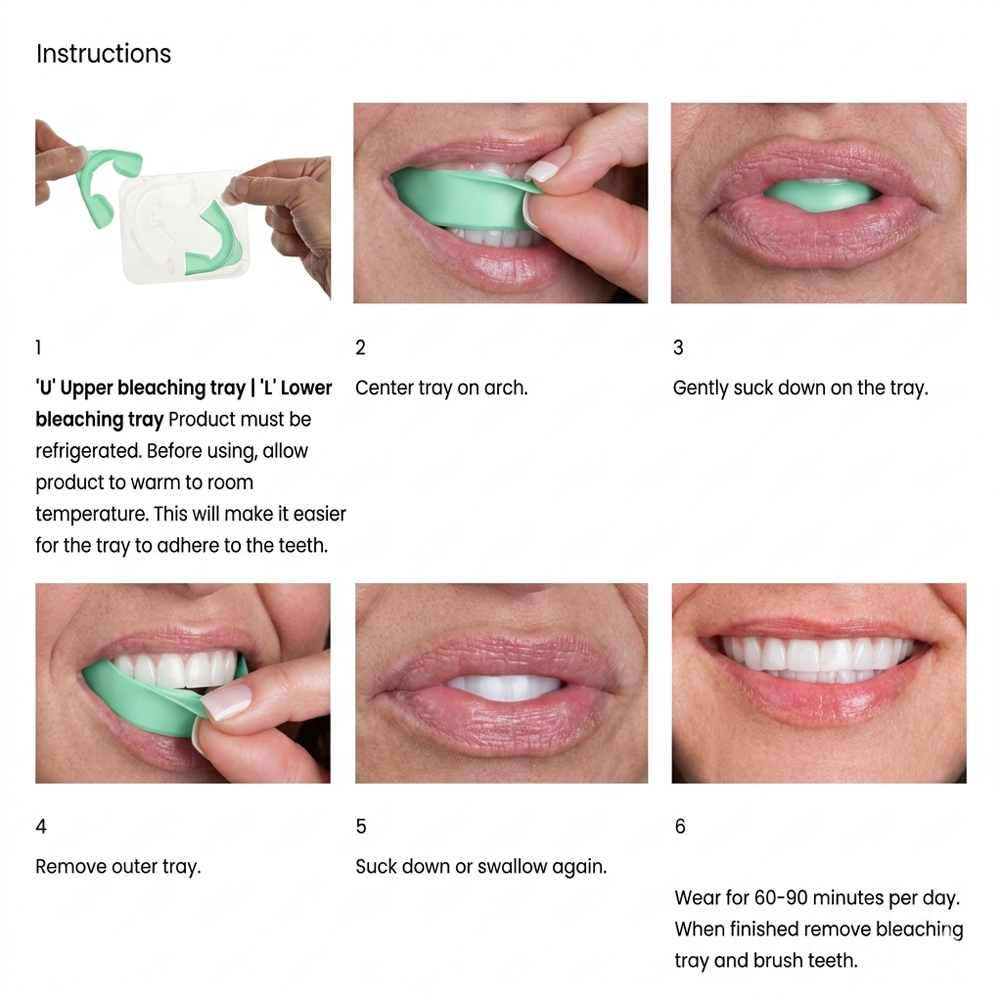 Отбеливающие капы Opalescence  – обзор и цена Teeth Whitening Opalescence