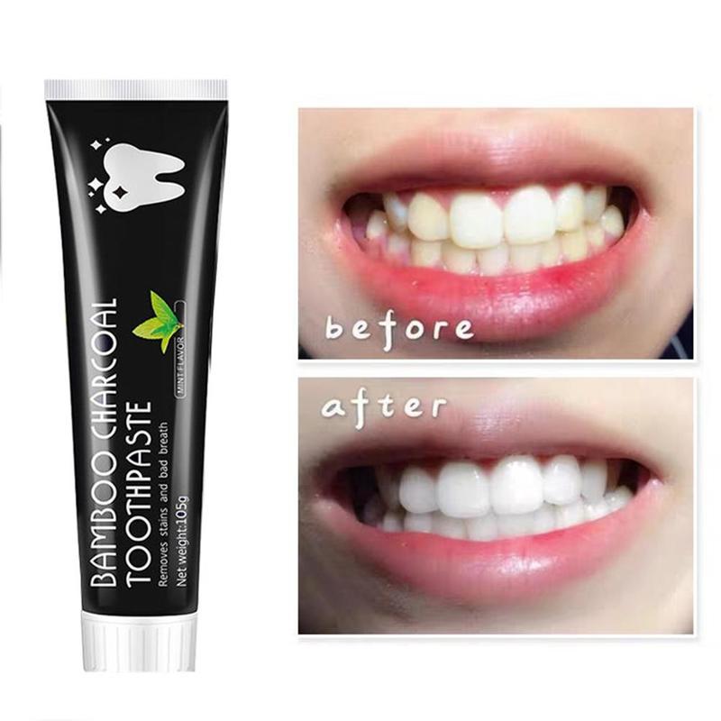 Отбеливающая зубная паста с ак – обзор и цена Teeth Whitening Charcoal